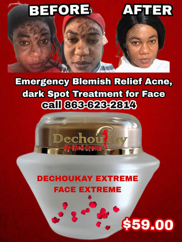 Déchoukay Extreme Face Cream 4oz