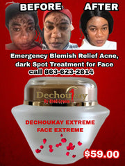 Déchoukay Extreme Face Cream 4oz